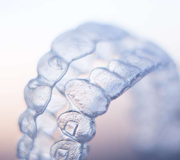 Paris ClearCorrect Braces