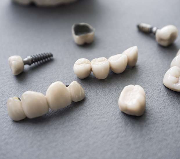 Paris The Difference Between Dental Implants and Mini Dental Implants
