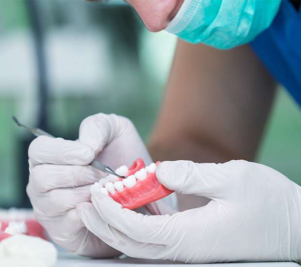 Paris Partial Denture for One Missing Tooth