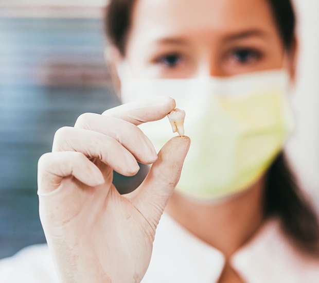 Paris Tooth Extraction