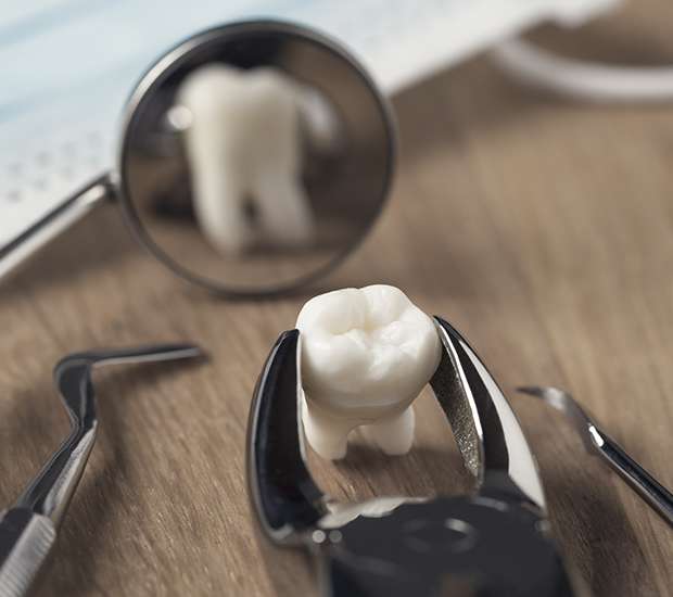 Paris When Is a Tooth Extraction Necessary